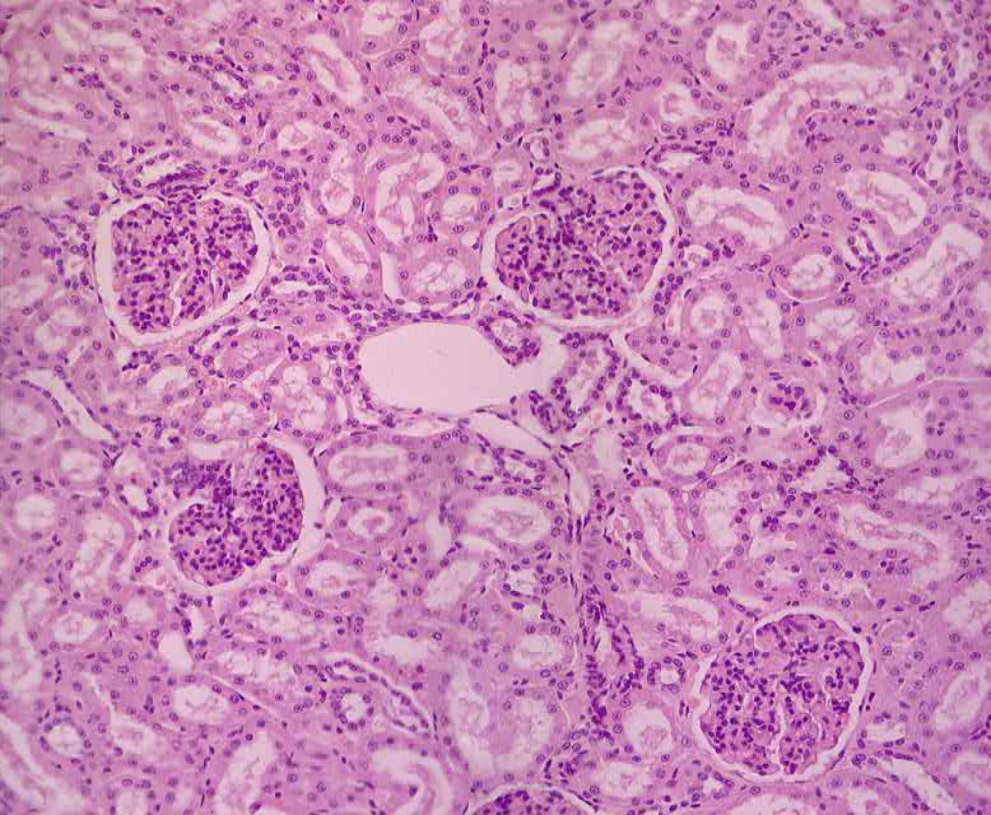 Kidney Medulla Under Microscope