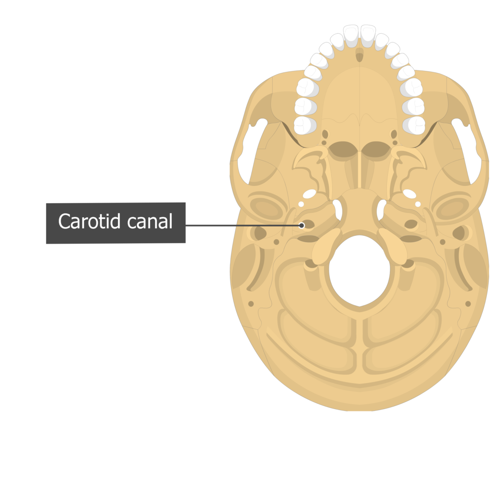 temporal bone carotid canal