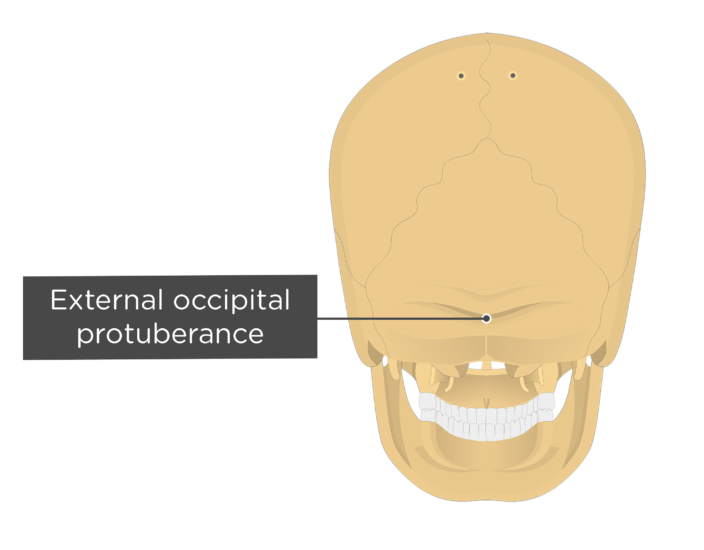 External Occipital Protuberance Massive External Occipital 5313