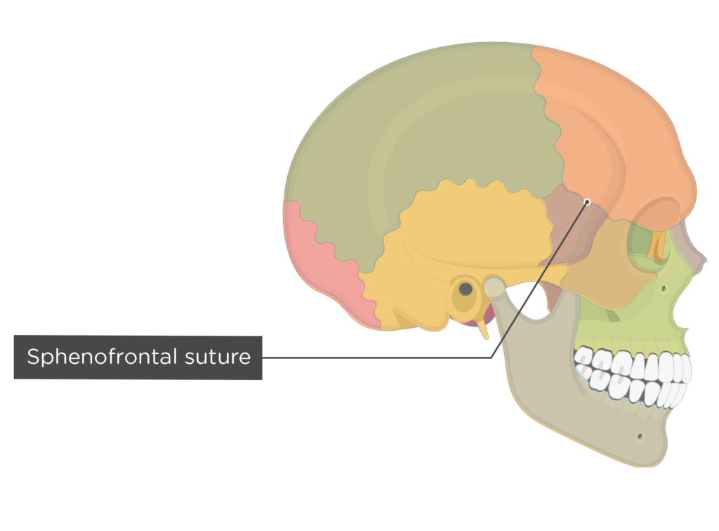 skull labeled sutures