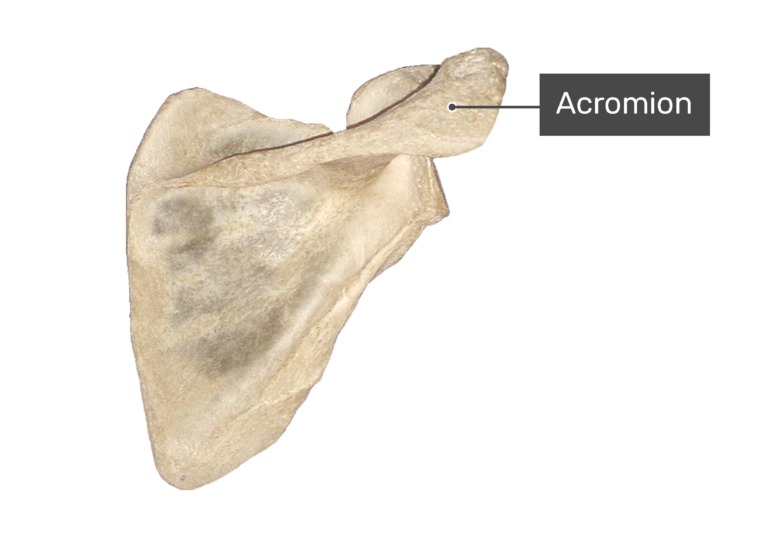 Posterior scapula bone with labeled acromion