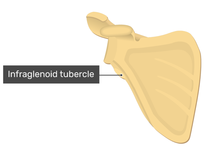 Anterior scapula with labeledInfraglenoid tubercle infraglenoid tubercle