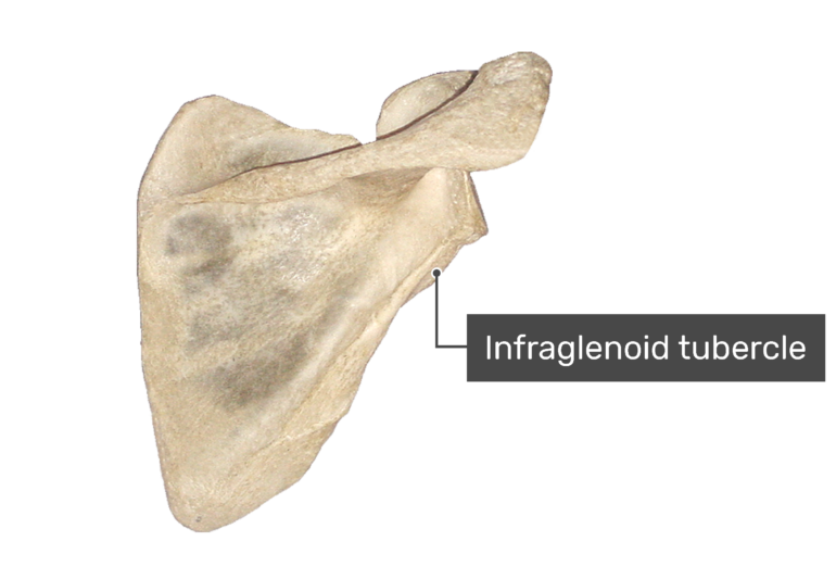 Posterior scapula bone with labeled infraglenoid cavity