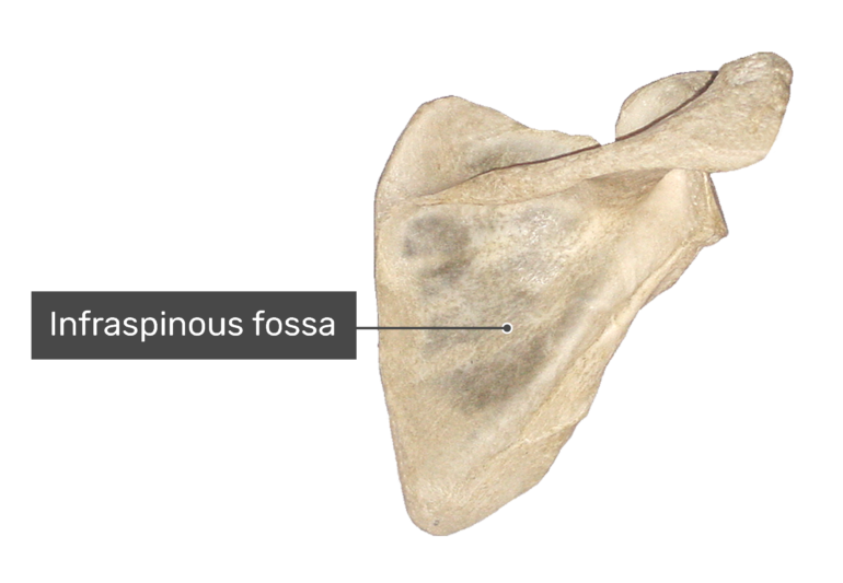 Posterior scapula bone with labeled infraspinous fossa