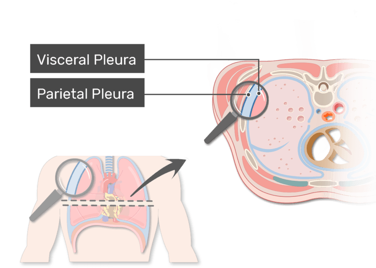 Pleural Cavity And Pleura Anatomy And Types Of Pleura Getbodysmart