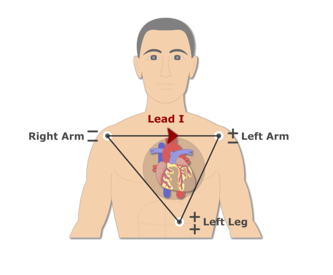 ECG Electrode Placement | GetBodySmart